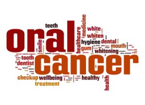 Oral cancer