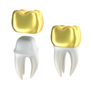 porcelain crowns