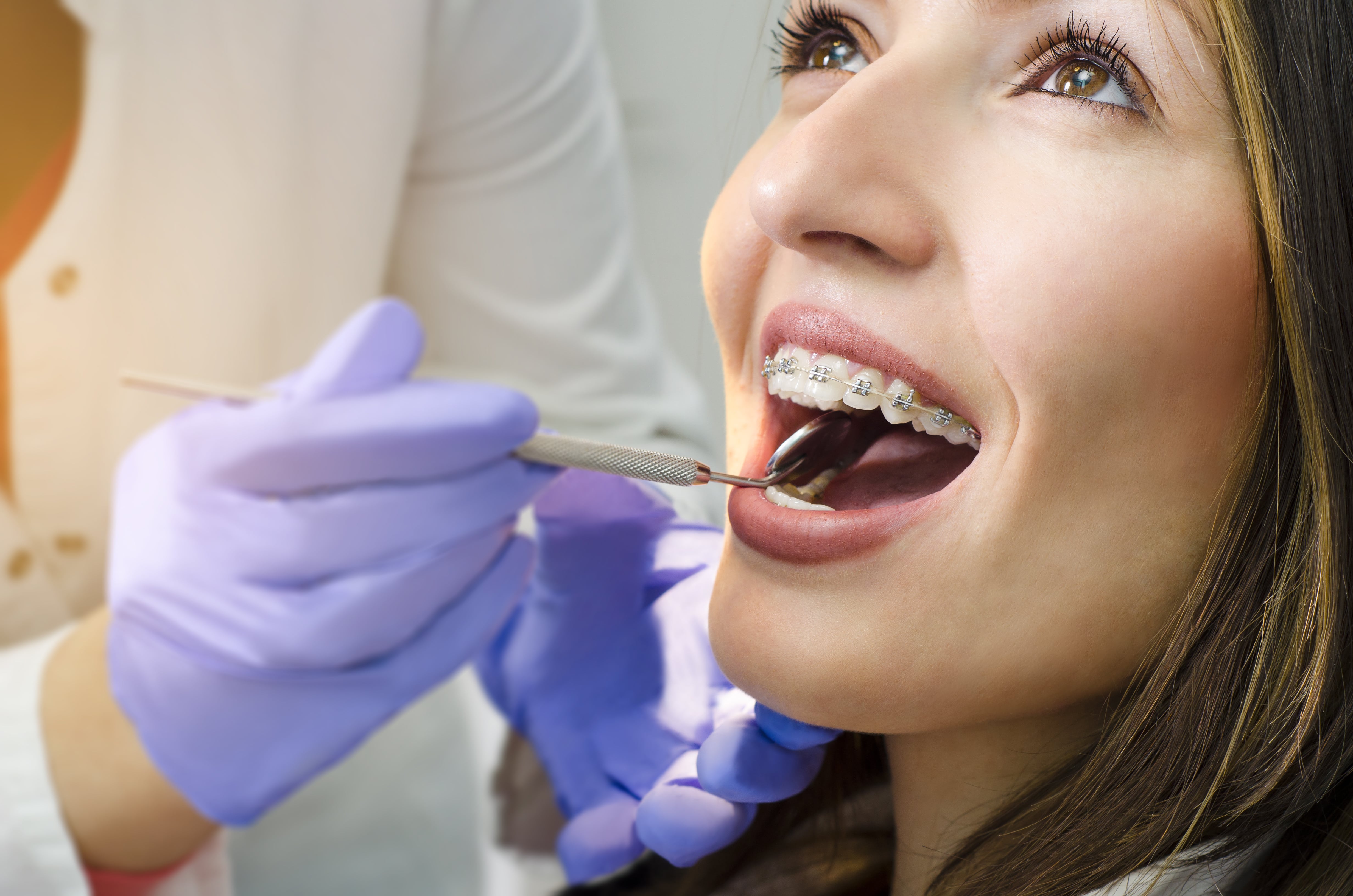 dental braces